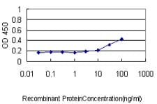 KRT33B / Keratin 33B / KRTHA3B Antibody (clone 4A6-A7)