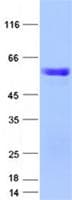 Human NIFK / MKI67IP Protein (Recombinant GST, N-terminus + His, C-terminus)