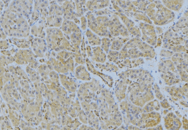IGHA1 / IgA1 Antibody