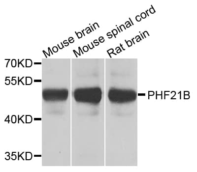 PHF21B Antibody