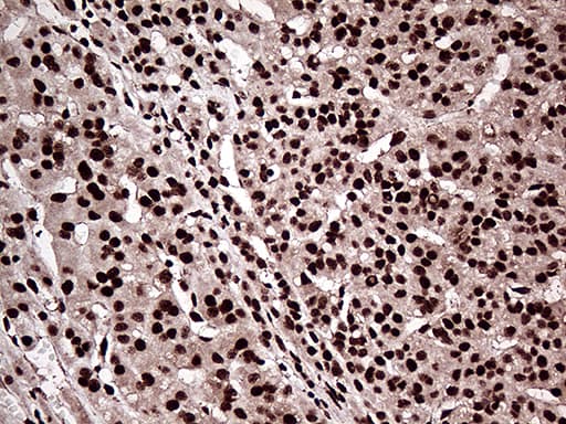 ZRANB2 / ZNF265 Antibody (aa95-320, clone OTI2E3, Carrier-free)