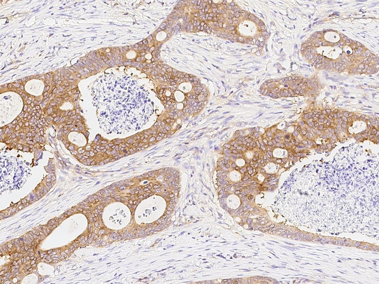 DARS Antibody (clone 11, Preservative Free)
