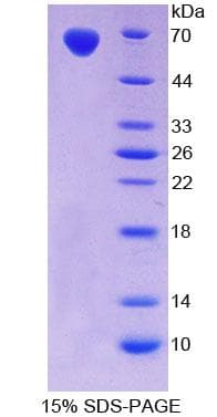 Rat TLR5 Protein (Recombinant His-GST)