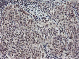 Monoclonal Mouse anti-Human DPH2 Antibody (clone OTI1A12, IHC, WB)