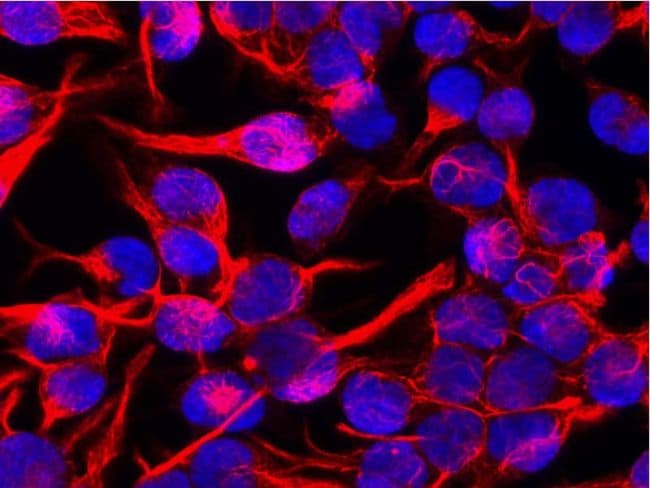 Vimentin Antibody (clone VI-01)