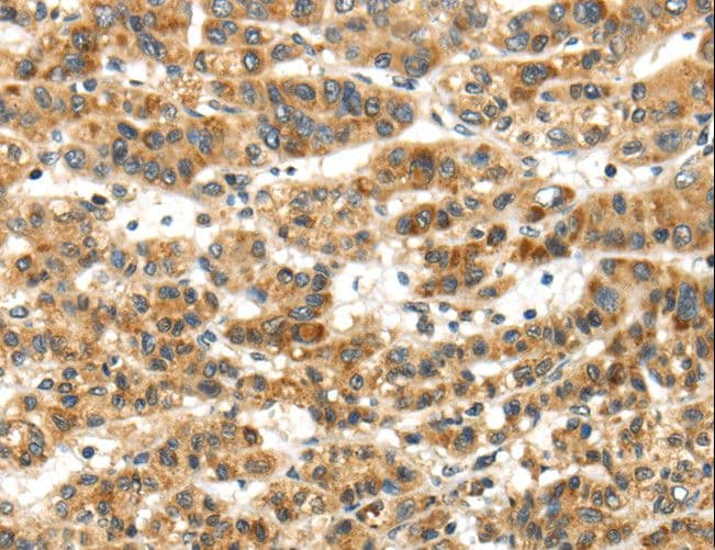 PAPPA / PAPP-A Antibody