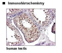 SLC2A9 / GLUT9 Antibody