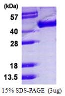 Influenza A Virus Influenza A H5N1 Hemagglutinin Protein (Recombinant His)