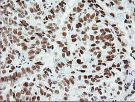 ERCC1 Antibody (clone 2.00E+12)