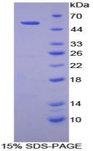 Human C2CD3 Protein (Recombinant His-GST)