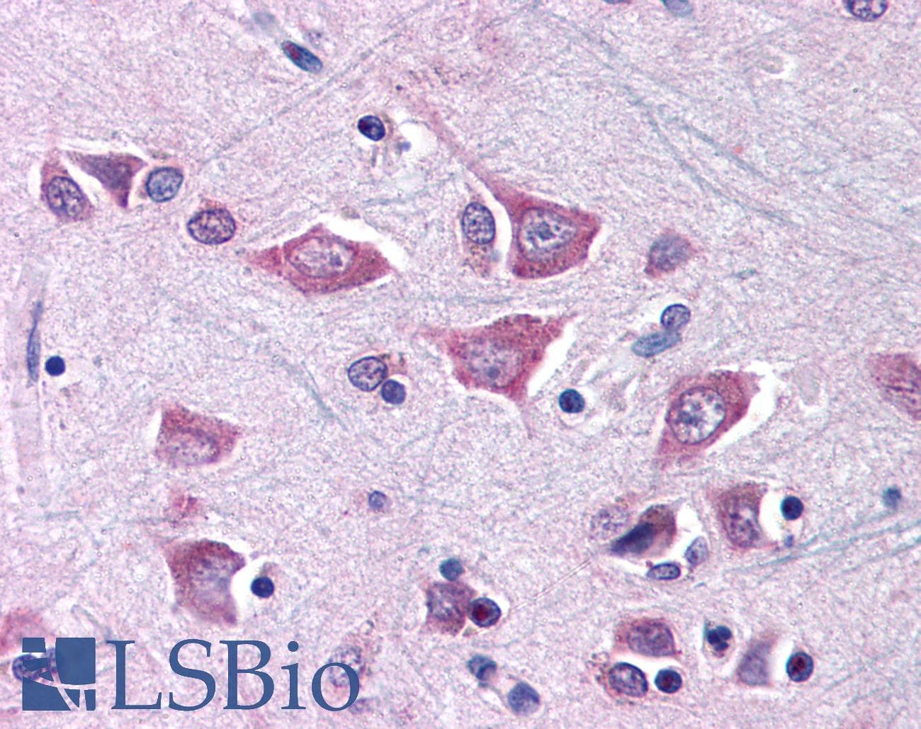 Polyclonal Rabbit anti-Human MCOLN1 / Mucolipin 1 Antibody (aa101-150, IHC, WB)