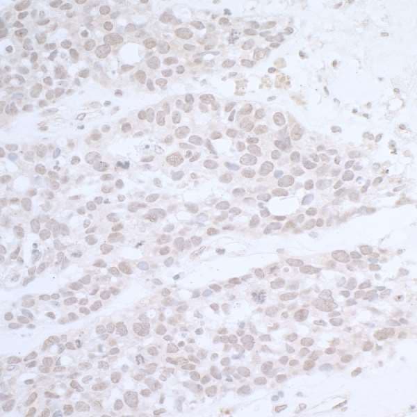 Polyclonal Rabbit anti-Human CTR9 Antibody (aa1123-1173, IHC, WB)