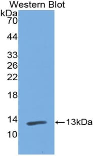 PIGR Antibody (aa230-331)