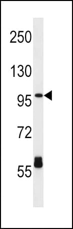 CPT1C Antibody (aa596-625)