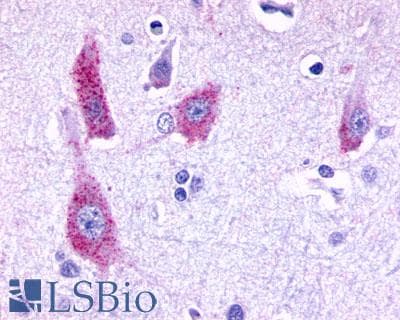 PathPlus™ HTR6 / 5-HT6 Receptor Antibody (C-Terminus)