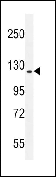 Polyclonal Rabbit anti-Human SGSM2 Antibody (aa955-984, IHC, WB)