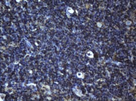 BCL10 / BCL-10 Antibody (clone OTI1B3)