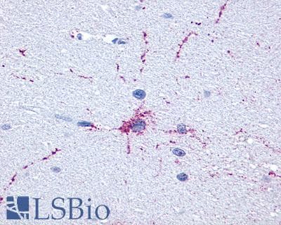 PathPlus™ GRM8 / MGLUR8 Antibody (C-Terminus)