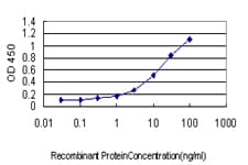 Monoclonal Mouse anti-Human PLA2G4A Antibody (clone 10G5, WB)
