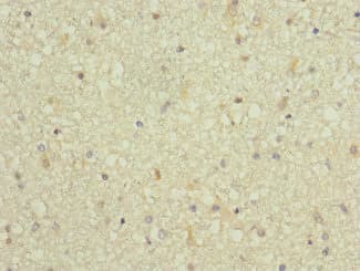 Polyclonal Rabbit anti-Human ARPC5 / p16-Arc Antibody (IHC)
