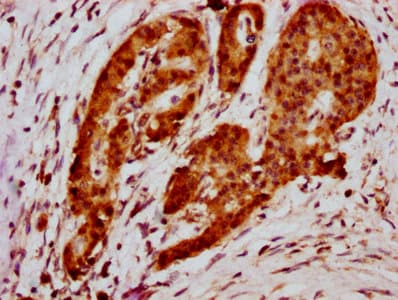 HIST1H2BN Antibody