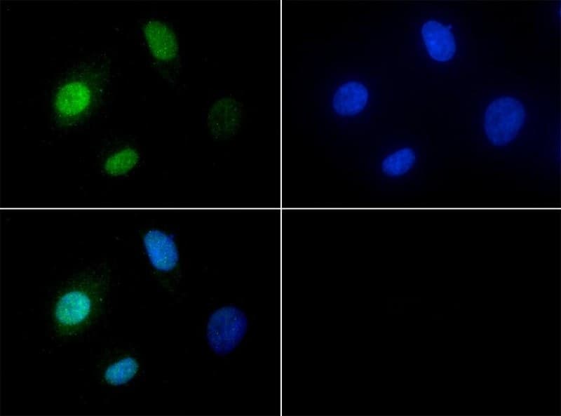 JHDM1A / KDM2A Antibody (Biotin)