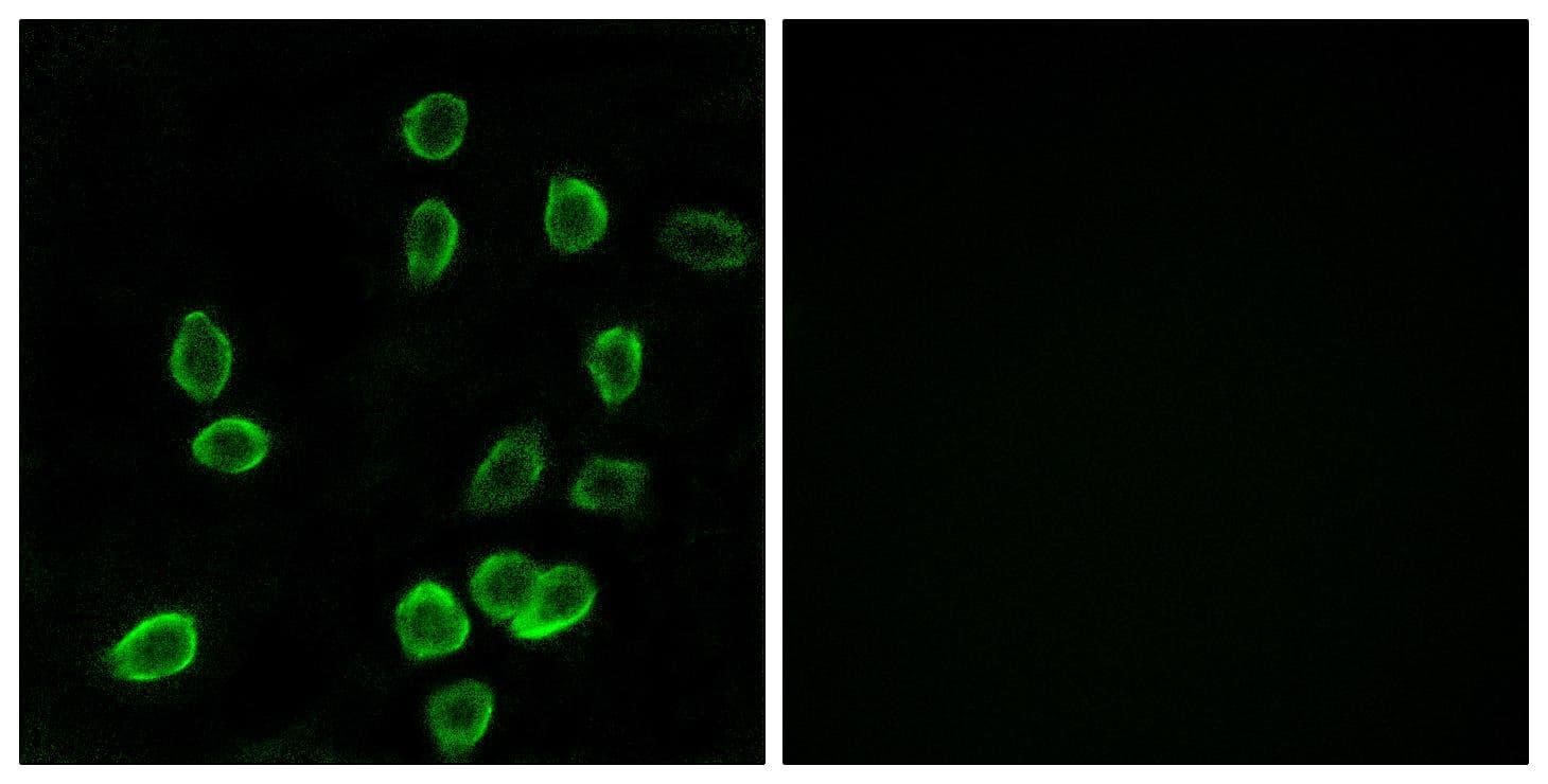 ATP5G3 Antibody