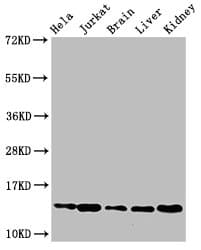 HIST1H2BB Antibody