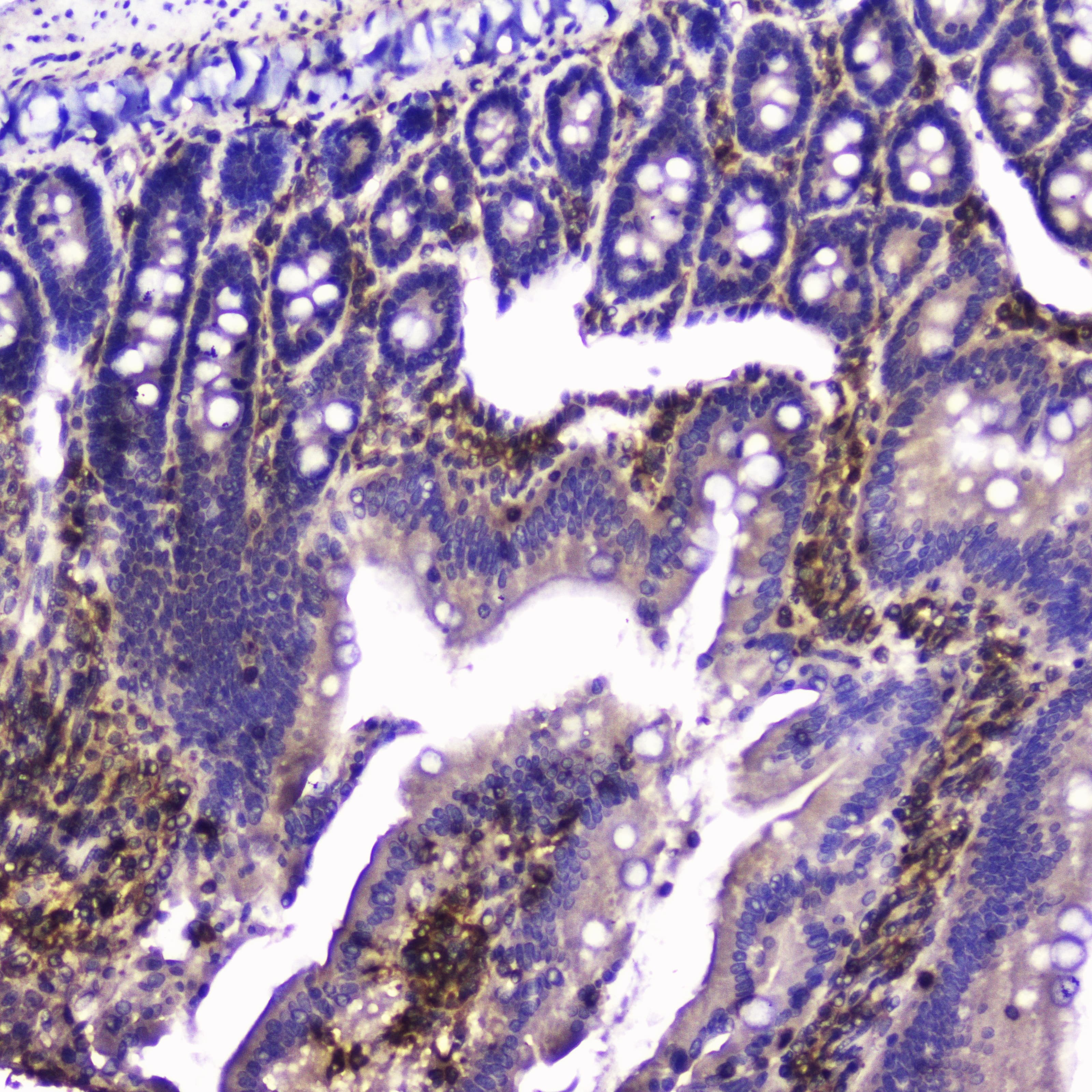 TLN1 / Talin 1 Antibody