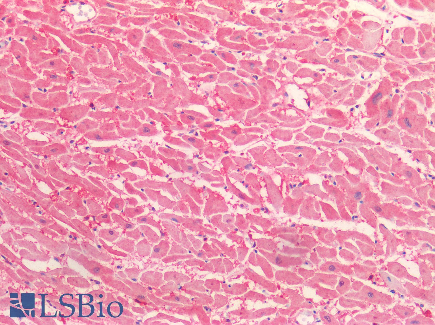 IHC-plus™ Polyclonal Rabbit anti-Human HTR2C / 5-HT2C Receptor Antibody (C-Terminus, IHC)