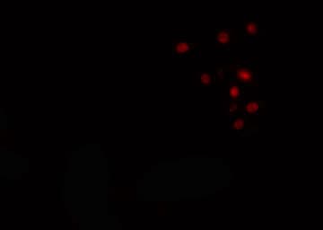 Polyclonal Rabbit anti-Human RBM5 / G15 Antibody (IHC, IF, WB)