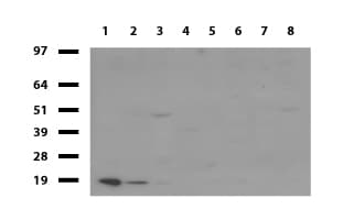 TNNC1 / Cardiac Troponin C Antibody (clone UMAB204)