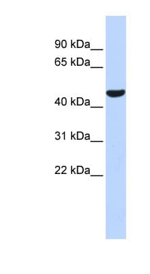 Polyclonal Rabbit anti-Human PGIS / PTGIS Antibody (aa396-445, WB)