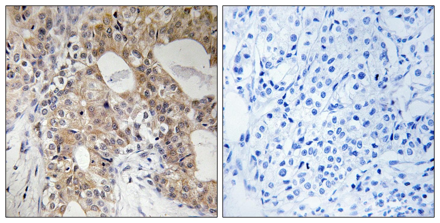 SPHK2 Antibody (phospho-Thr614)