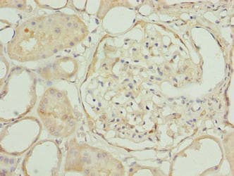 EPM2AIP1 Antibody