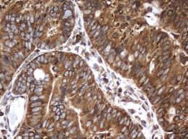 PAI-RBP1 / SERBP1 Antibody (clone OTI2F6)