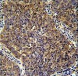 Polyclonal Rabbit anti-Human CD2BP2 Antibody (aa24-52, IHC, WB)
