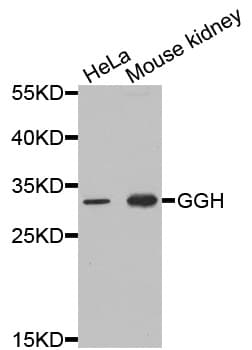 Polyclonal Rabbit anti-Human GGH / Gamma-Glutamyl Hydrolase Antibody (IHC, IF, WB)