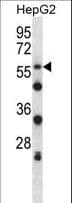 SIGLEC8 Antibody (aa94-122)
