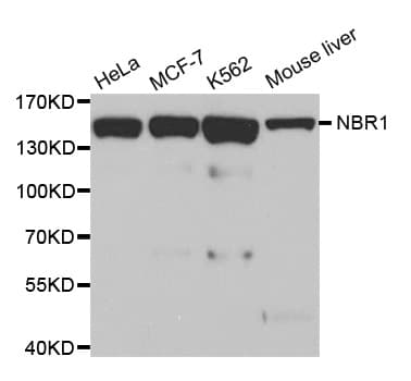 Polyclonal Rabbit anti-Human NBR1 Antibody (IHC, IF, WB)