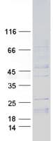 Human IL15 Protein (Recombinant Myc-DDK (Flag))