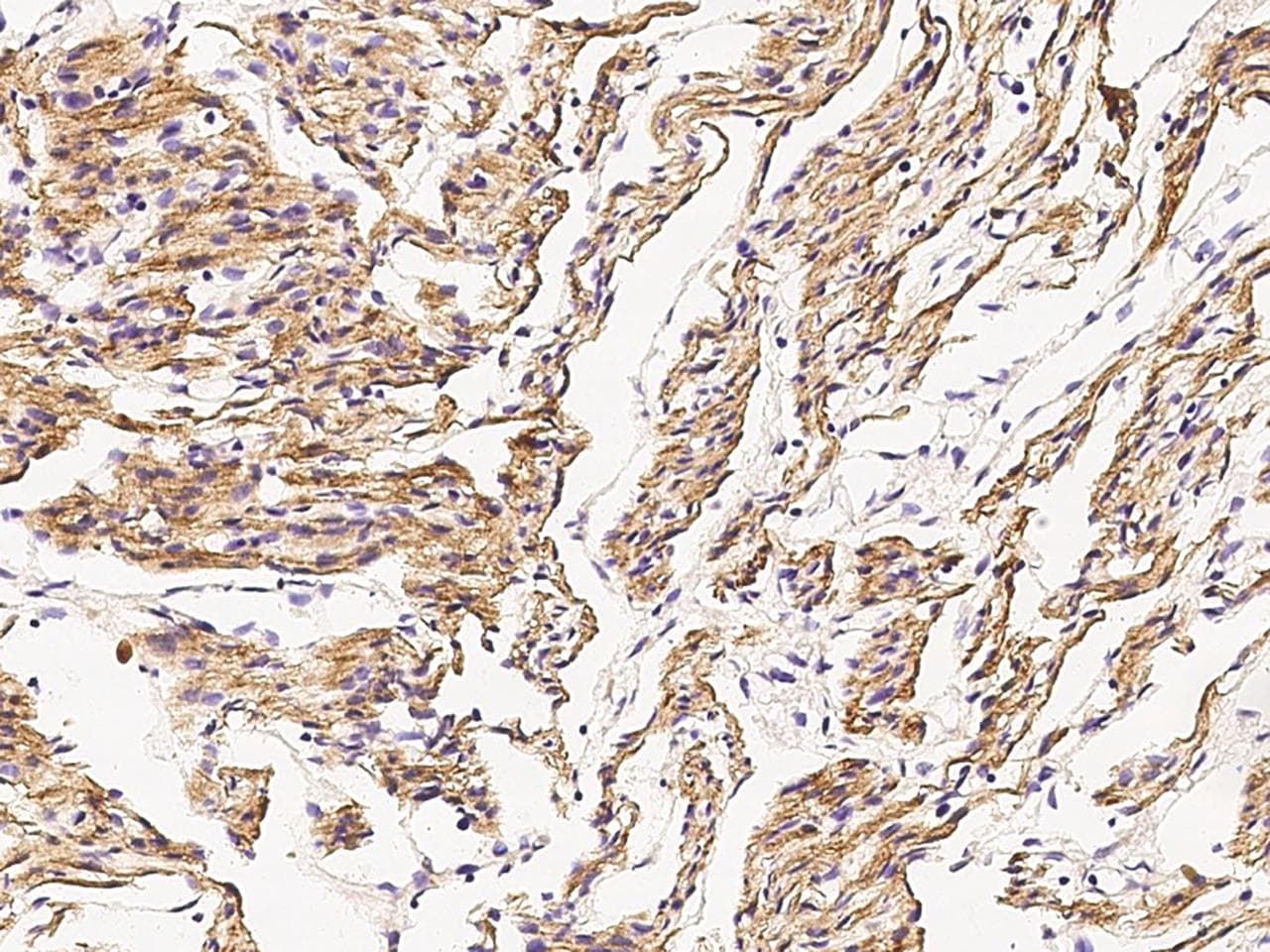 Monoclonal Mouse anti-Human DES / Desmin Antibody (clone 18, Preservative Free, IHC)