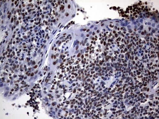 DDX56 Antibody (aa323-547, clone OTI11H7, Carrier-free)