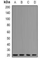 CETN3 Antibody