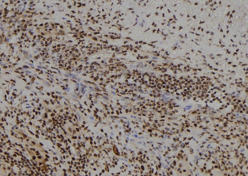 Polyclonal Rabbit anti-Human FSBP Antibody (IHC, WB)