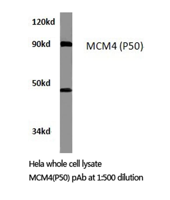 Polyclonal Rabbit anti-Human MCM4 Antibody (Pro50, IHC, WB)