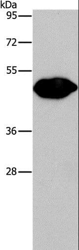 PLIN2 / ADFP / Adipophilin Antibody