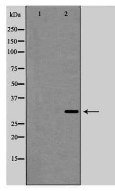 IL-1B / IL-1 Beta Antibody