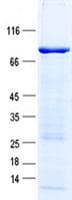 Human ALDH1A3 Protein (Recombinant GST, N-terminus + His, C-terminus)