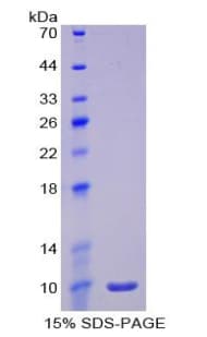 Rat IL6R / IL6 Receptor Protein (Recombinant His)